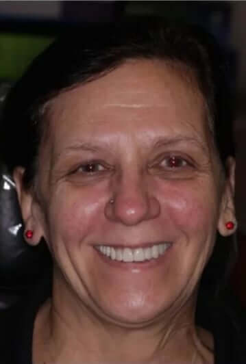 smile gallery image