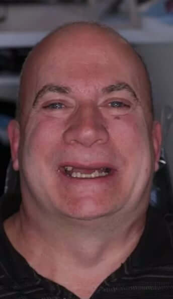 smile gallery image