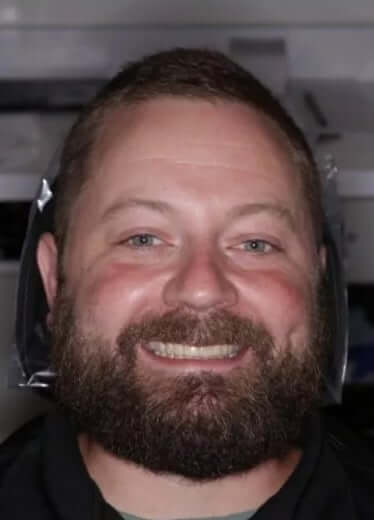 smile gallery image