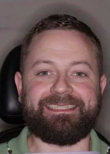 smile gallery image