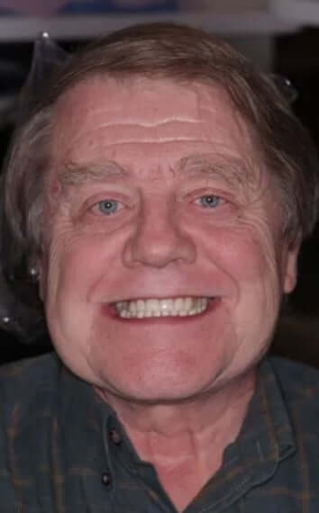 smile gallery image