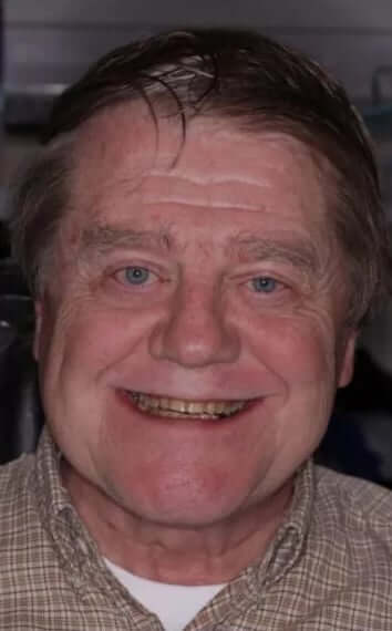 smile gallery image