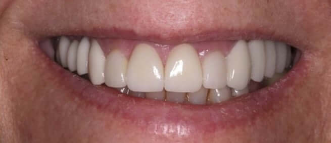 smile gallery image