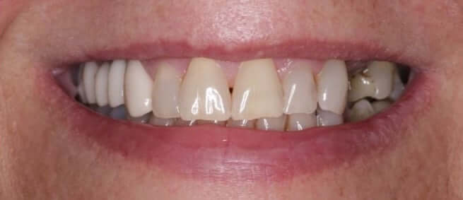 smile gallery image