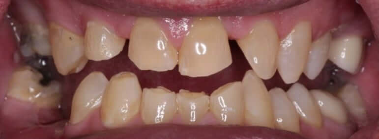 smile gallery image