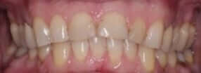 smile gallery image