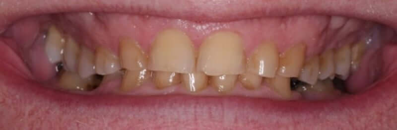 smile gallery image