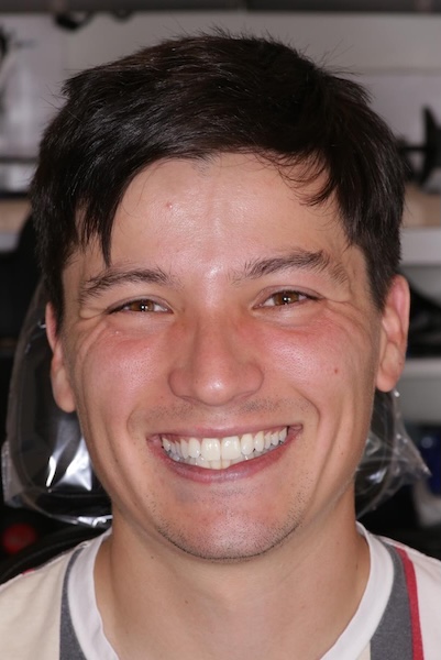 smile gallery image