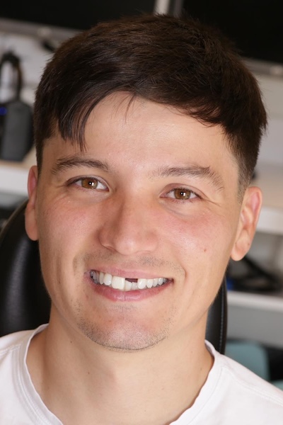 smile gallery image
