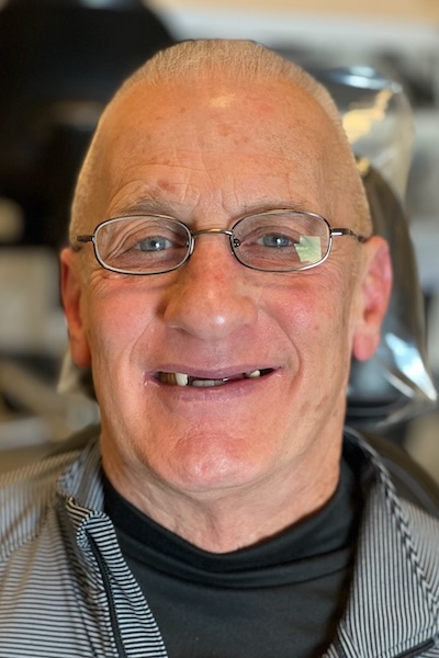 smile gallery image