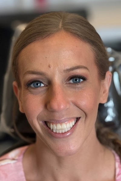smile gallery image