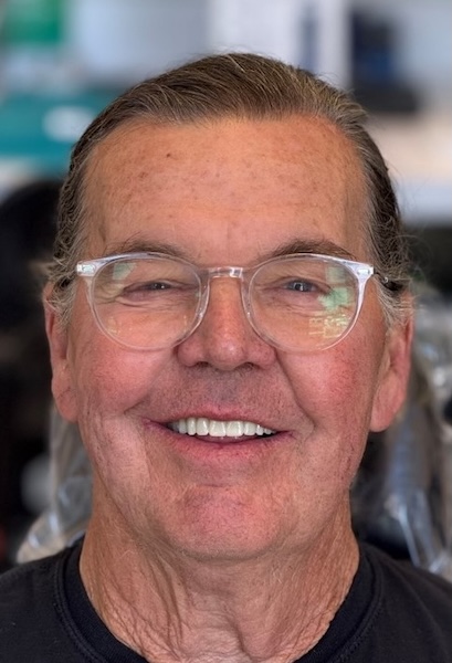smile gallery image