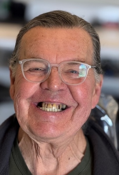 smile gallery image