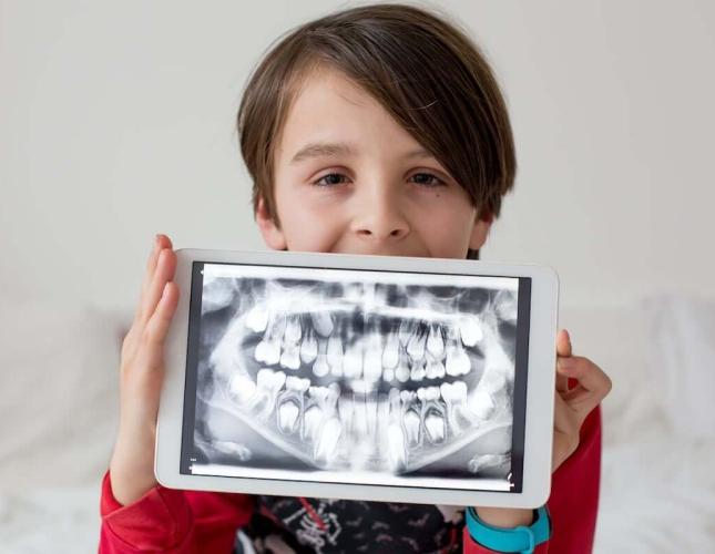 Are Dental X-Rays Safe for Children? Separating Fact from Fiction