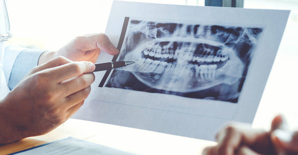 Image of a dentist pointing to an x-ray